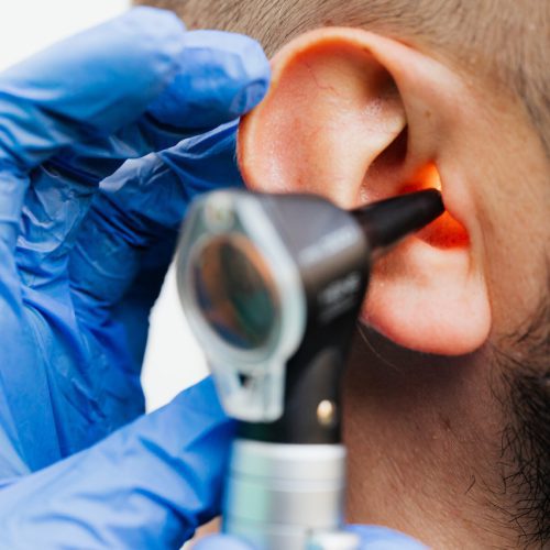 Jak odetkać ucho w domu – skuteczne metody i porady
